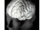 Embolias cerebrales, terapia | Recurso educativo 52698