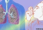 What causes Asthma? | Recurso educativo 746943