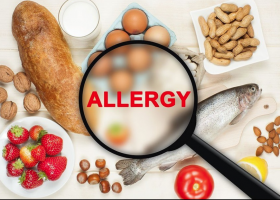 Food Allergies | Recurso educativo 771655