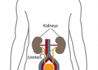 Your Kidneys & How They Work | NIDDK | Recurso educativo 776243